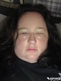 世界上最胖的人1400斤还嫌不够胖（世界上十大最胖的人）